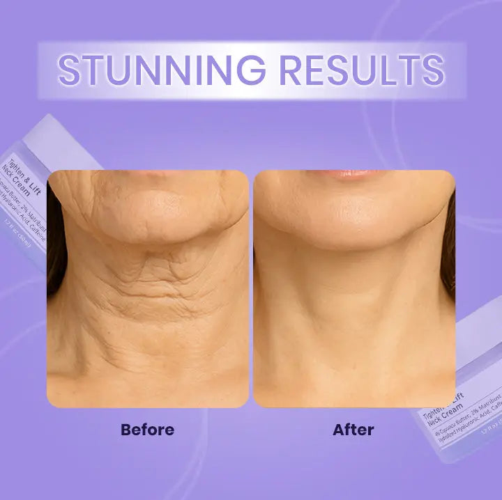 Tighten & Lift Neck Cream Souq Trendify