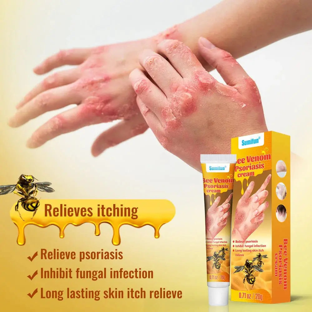 Summifun - Bee Venom Psoriasis Cream Devour