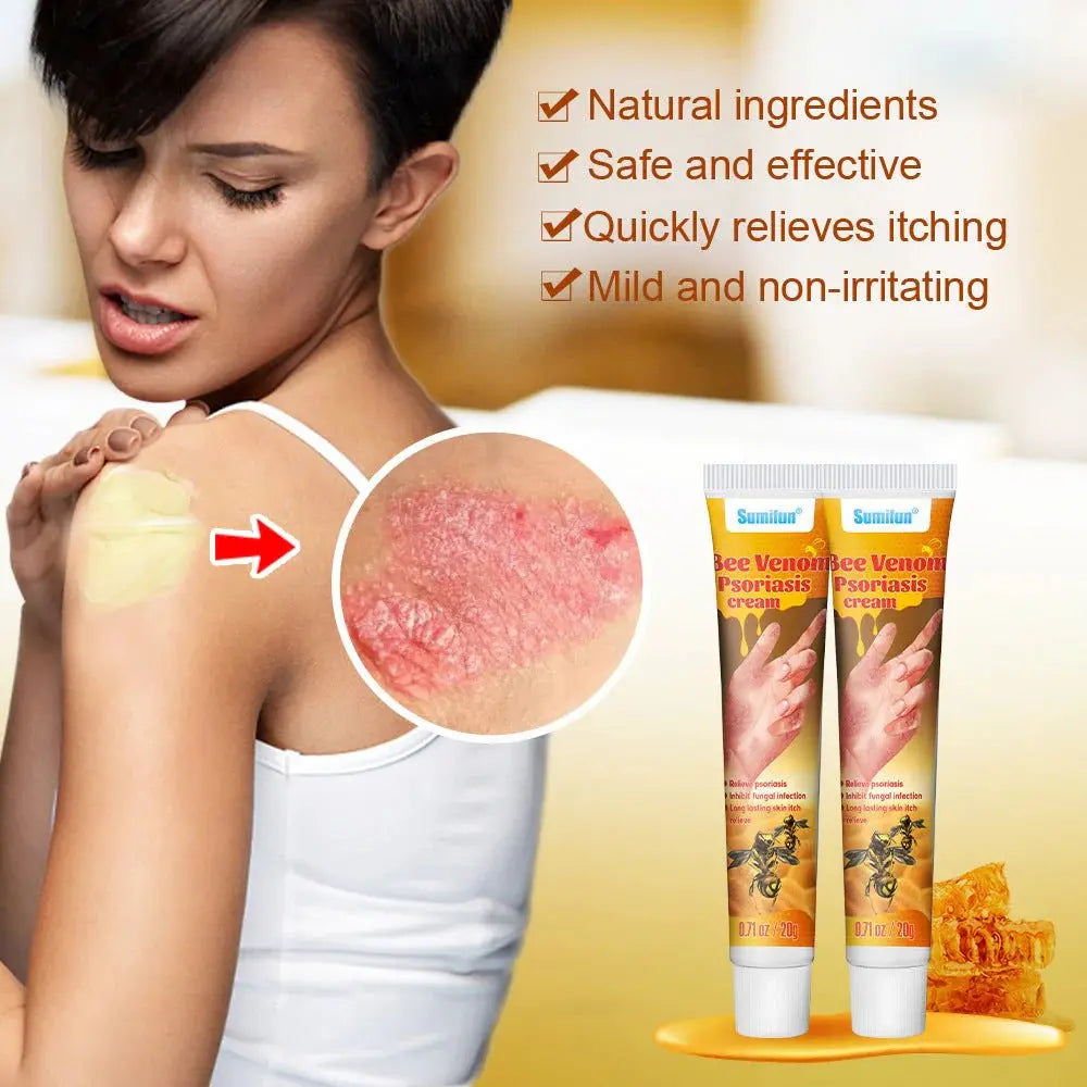 Summifun - Bee Venom Psoriasis Cream Devour